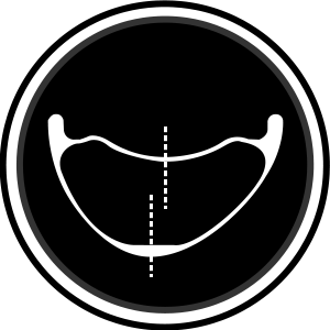 Asymmetry.png